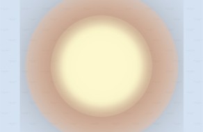 Sonnen 10 maTabu_So-qua-A10c